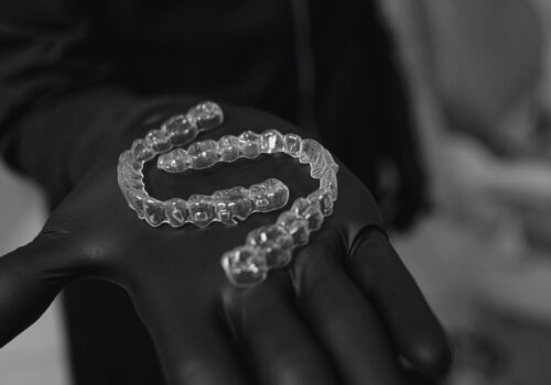 Aligner Behandlung für leichte bis mittler Fehlstellungen bei den Zähnen