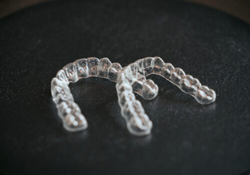 Aligner Behandlung für leichte bis mittler Fehlstellungen bei den Zähnen